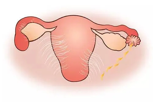 附件炎是哪个位置疼痛 附件炎是哪个位置疼痛