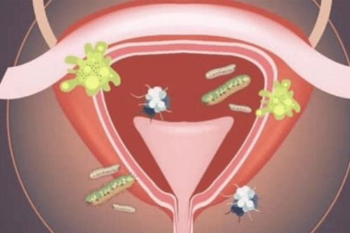 妇科验证有那些 妇科验证有那些
