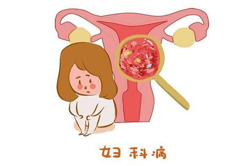 妇科炎症会导致什么结果 妇科炎症会导致什么结果